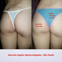 Kit Autoestima em dia